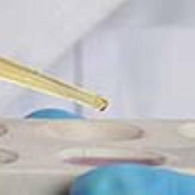 سلول های سفید و قرمز خون در ادرار