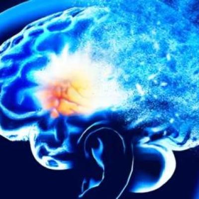 این 15 عامل باعث می شوند احتمال ابتلا شما به آلزایمر زودرس افزایش پیدا کند